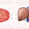 Não gan: nguyên nhân, triệu chứng và điều trị bệnh